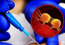 THE TRUTH ABOUT WHETHER A BIOPSY CAN SPREAD YOUR CANCER (SEPARATING MYTH FROM MEDICAL REALITY)