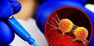 THE TRUTH ABOUT WHETHER A BIOPSY CAN SPREAD YOUR CANCER (SEPARATING MYTH FROM MEDICAL REALITY)