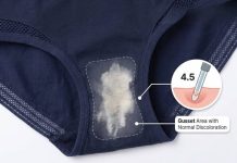 NOTICED A BLEACH-LIKE STAIN ON YOUR UNDERWEAR? HERE’S WHAT IT REALLY MEANS FOR YOUR HEALTH