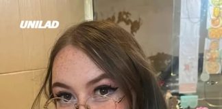 Woman whose breasts ‘never stop growing’ describes how medical condition macromastia makes dating more difficult