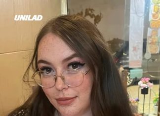 Woman whose breasts ‘never stop growing’ describes how medical condition macromastia makes dating more difficult