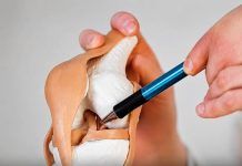 THE 6 COMMON FOODS THAT SILENTLY DRAIN CALCIUM FROM YOUR BODY (WHY EATING THESE REGULARLY COULD BE MAKING YOUR BONES BRITTLE AND WE