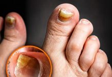 THE TWO SILENT FOOT KILLERS HEALTH EXPERTS WANT YOU TO KNOW ABOUT (HOW TO SPOT THE WARNING SIGNS)