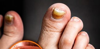 THE TWO SILENT FOOT KILLERS HEALTH EXPERTS WANT YOU TO KNOW ABOUT (HOW TO SPOT THE WARNING SIGNS)