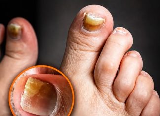 THE TWO SILENT FOOT KILLERS HEALTH EXPERTS WANT YOU TO KNOW ABOUT (HOW TO SPOT THE WARNING SIGNS)