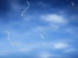 EYE FLOATERS: HARMLESS SPECKS OR HIDDEN WARNING SIGNS?