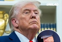 White House releases result of Trump’s physical exam after health concerns