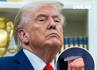 White House releases result of Trump’s physical exam after health concerns