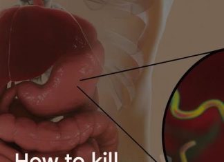 How to eliminate the bacteria responsible for heartburn and bloating