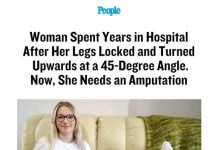 Woman Spent Years in Hospital After Her Legs Locked and Turned Upwards at a 45-Degree Angle. Now, She Needs an Amputation