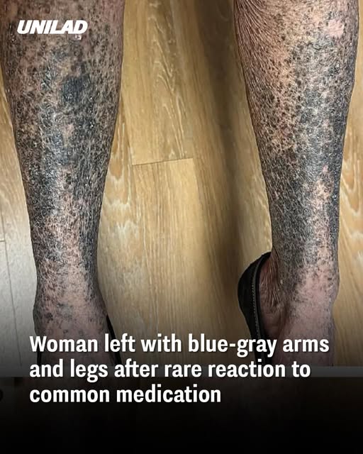legs