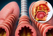 BREATHE EASY: 9 SIMPLE & NATURAL WAYS TO CLEAR PHLEGM AND MUCUS FROM YOUR CHEST AND THROAT