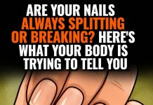 THE 7 CRITICAL HEALTH WARNINGS HIDDEN ON YOUR FINGERNAILS (WHY YOUR DOCTOR ALWAYS LOOKS AT YOUR HANDS AND WHAT THOSE STRANGE RIDGES ACTUALLY MEAN)