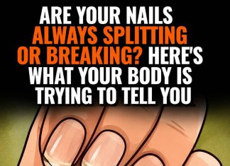 THE 7 CRITICAL HEALTH WARNINGS HIDDEN ON YOUR FINGERNAILS (WHY YOUR DOCTOR ALWAYS LOOKS AT YOUR HANDS AND WHAT THOSE STRANGE RIDGES ACTUALLY MEAN)