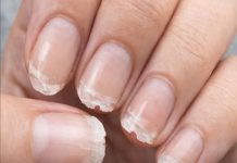 Brittle or Weak Nails? Your Body Might Be Trying to Tell You Something…