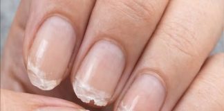 Brittle or Weak Nails? Your Body Might Be Trying to Tell You Something…