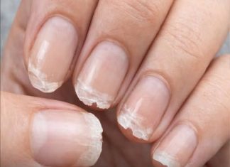 Brittle or Weak Nails? Your Body Might Be Trying to Tell You Something…