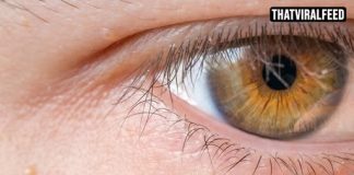 Experts Warn About White Bumps That Appear On The Body And Private Areas. Here’s What They Really Are