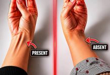 IF A TENDON POPS UP WHEN YOU TOUCH YOUR PINKY TO YOUR THUMB, HERE’S THE SURPRISING REASON WHY