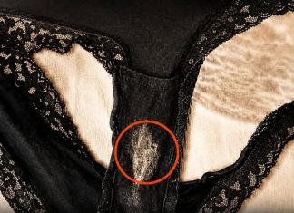 NOTICED A BLEACH-LIKE STAIN ON YOUR UNDERWEAR? HERE’S WHAT IT REALLY MEANS FOR YOUR HEALTH