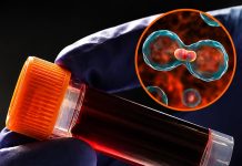 THE SHOCKING CONNECTION BETWEEN YOUR BLOOD TYPE AND YOUR RISK FOR SERIOUS DISEASE (YOUR GENETIC BLUEPRINT)