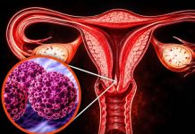 CATCH IT EARLY: 5 ESSENTIAL WARNING SIGNS OF CERVICAL CANCER EVERY WOMAN NEEDS TO KNOW