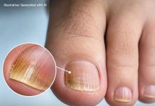 THE TWO SILENT FOOT KILLERS HEALTH EXPERTS WANT YOU TO KNOW ABOUT (HOW TO SPOT THE WARNING SIGNS)