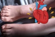 One Month Before A Heart Attack, Your Feet Will W.arn You Of These 6 Signs