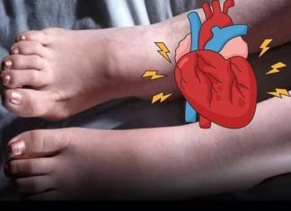 One Month Before A Heart Attack, Your Feet Will W.arn You Of These 6 Signs
