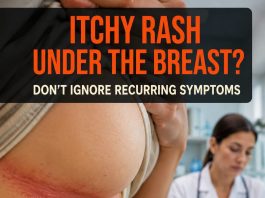 THE MOST COMMON CAUSES OF UNDERBOOB RASHES (HOW TO PREVENT AND TREAT THEM NATURALLY)