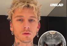 Risks of blackout tattoos as Machine Gun Kelly reveals horrifying side effects he experienced