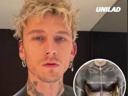 Risks of blackout tattoos as Machine Gun Kelly reveals horrifying side effects he experienced