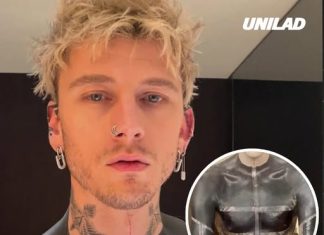 Risks of blackout tattoos as Machine Gun Kelly reveals horrifying side effects he experienced