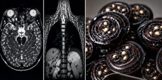 THE 8 COMMON FOODS THAT CARRY THE HIGHEST RISK OF FOOD POISONING (PROTECT YOUR FAMILY FROM THESE HIDDEN DANGERS)