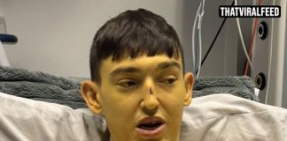 25-Year-Old Woke Up ‘Bart Simpson’ Yellow — And The Cause Went Back To Infancy