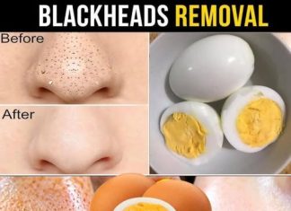 Say Goodbye to Blackheads with Just One Egg – Here’s How!