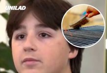 Teenager loses part of his bowel after swallowing grill brush bristle that was inside burger