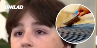 Teenager loses part of his bowel after swallowing grill brush bristle that was inside burger