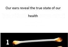 Our ears reveal the true state of our health