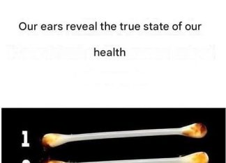 Our ears reveal the true state of our health