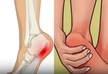 7 Exercises to Help Relieve Heel Discomfort and Support Foot Health