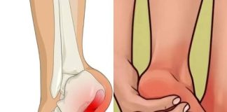 7 Exercises to Help Relieve Heel Discomfort and Support Foot Health