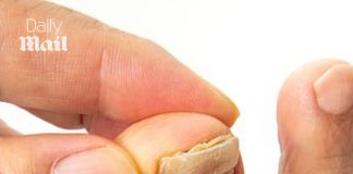 So many of us are struggling with embarrassing crusty, yellow toenails. This is the surprising habit that often triggers the problem – and exactly how to fix it: DR PHILIPPA KAYE