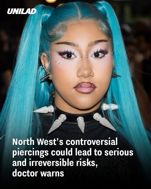 north