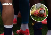 Doctor explains what causes ‘pump bump’ that has World Cup players cutting the back of soccer cleats