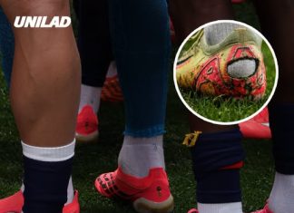 Doctor explains what causes ‘pump bump’ that has World Cup players cutting the back of soccer cleats