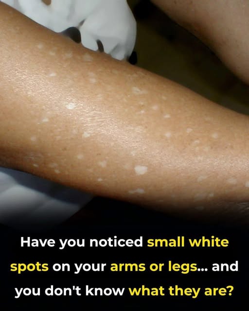 spots