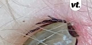 Rare tick-borne virus with no cure is spreading across the US as cases hit record high – how to avoid it