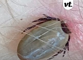 Rare tick-borne virus with no cure is spreading across the US as cases hit record high – how to avoid it