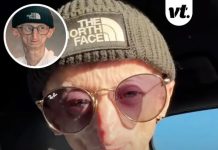 Influencer with rare disorder that causes rapid aging dies at 28